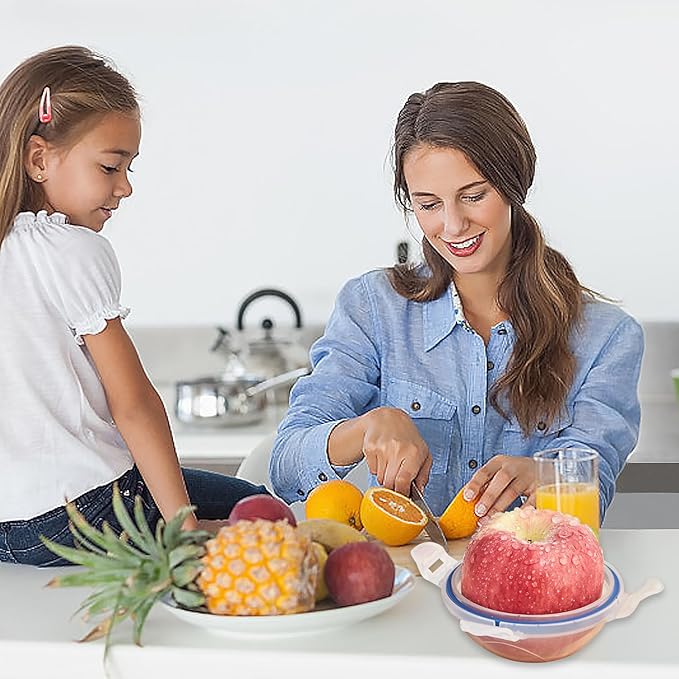 4 Pack Onion Storage Containers, Portable Fruit and Vegetable Savers Storage Containers, Onion Storage Keeper Containers for Fridge, Reusable Onion Holder Organizer for Tomato Lemon Apple